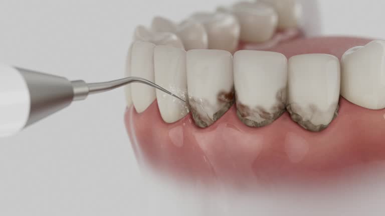Trusted Teeth Cleaning And Checkup service in Nampa, ID - Dentist Open Now